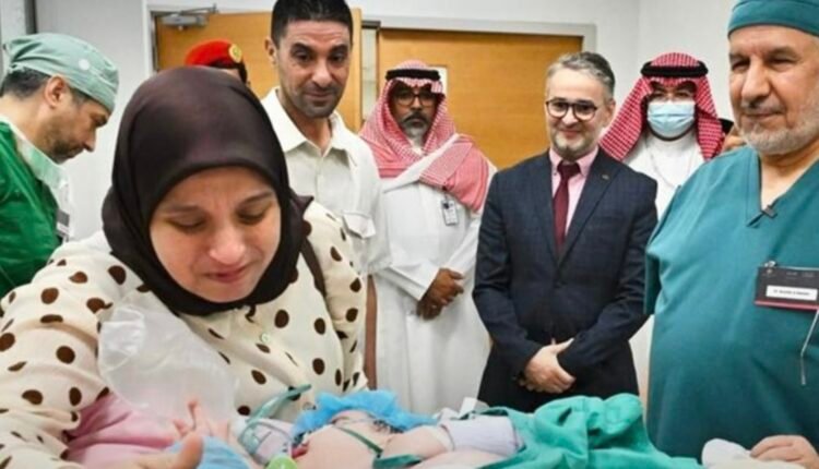King Abdullah Specialized Children’s Hospital in Riyadh, where Saudi doctors are conducting separation surgery for Moroccan conjoined twins Saja and Doha.